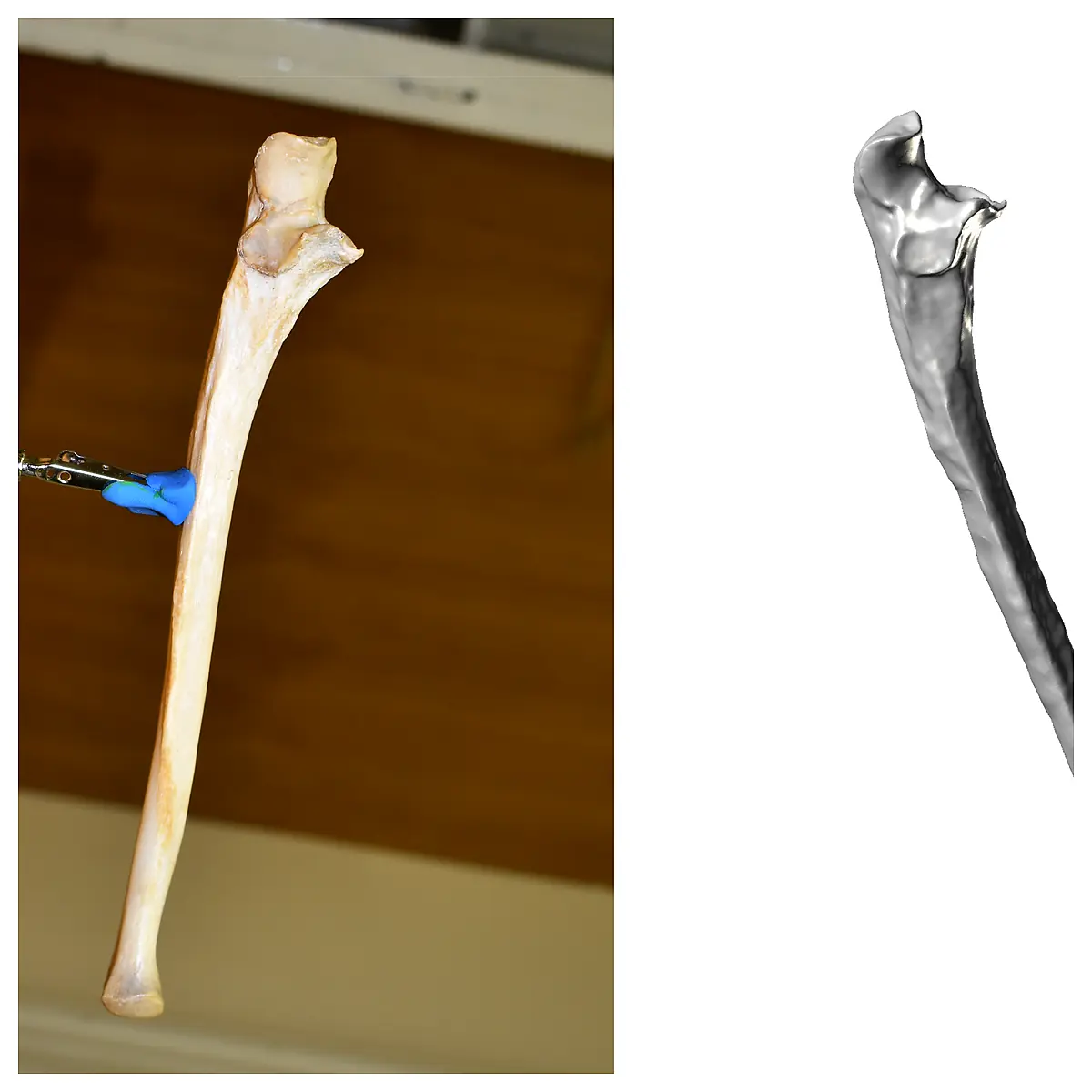 Forearm Bone Scan Ulna Imaging Diagnostics Bone Analysis Fracture Detection Bone Health Radiology Exam