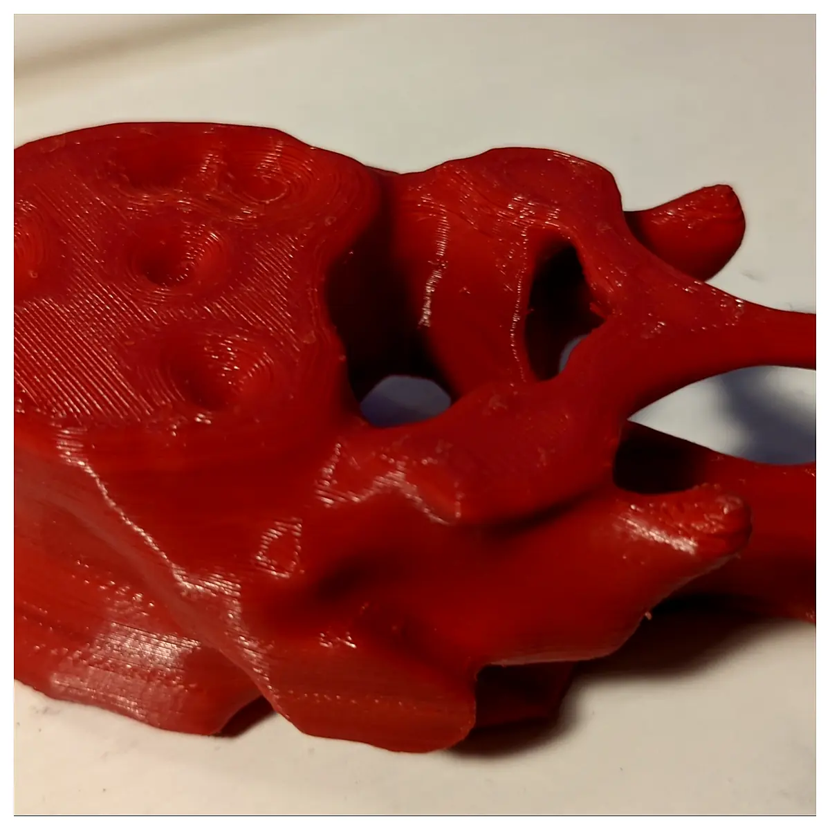 CT Scan Real Human Spinal Vertebra Spinal Bone Model Anatomy Learning Orthopedic Research Vertebral Part Medical Education