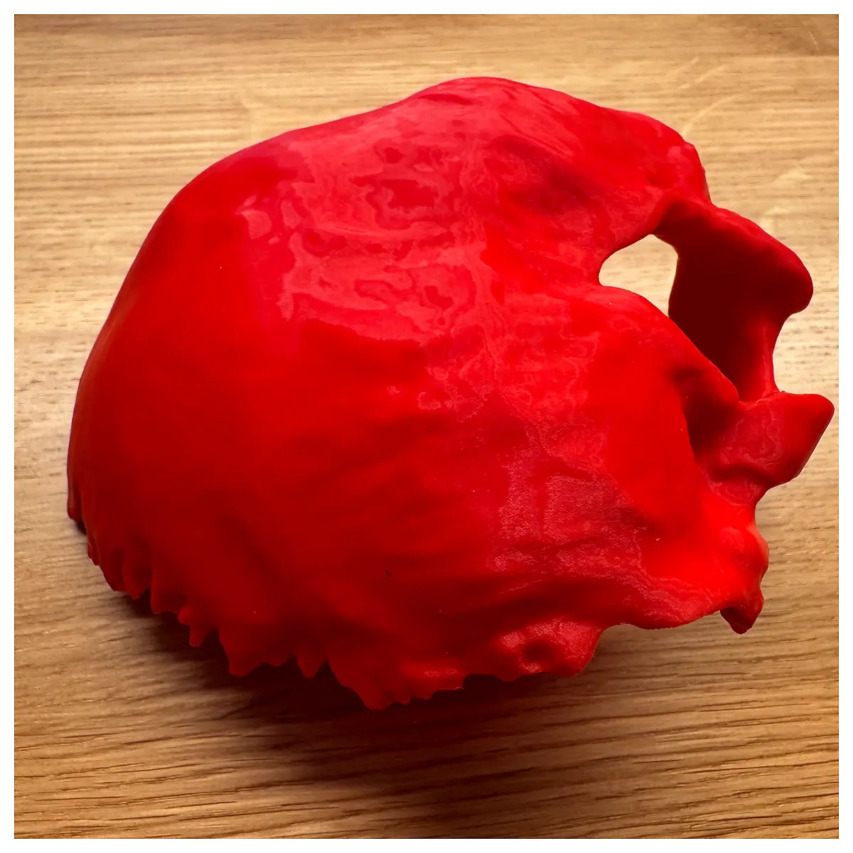 Occipital Bone Support Cranial Anatomy Accessory Skull Repair Bone Structure Research Neuroanatomy Study