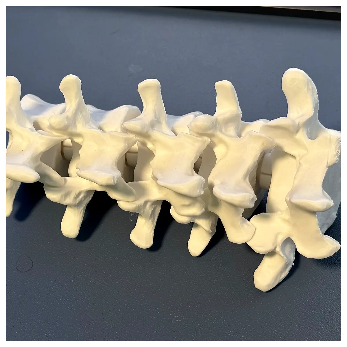 Lumbar Support Spine Support Vertebral Disc Herniation Treatment Spinal Protection