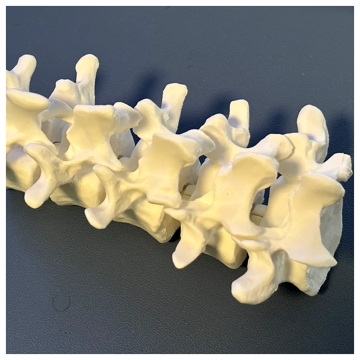 Lumbar Support Spine Support Vertebral Disc Herniation Treatment Spinal Protection