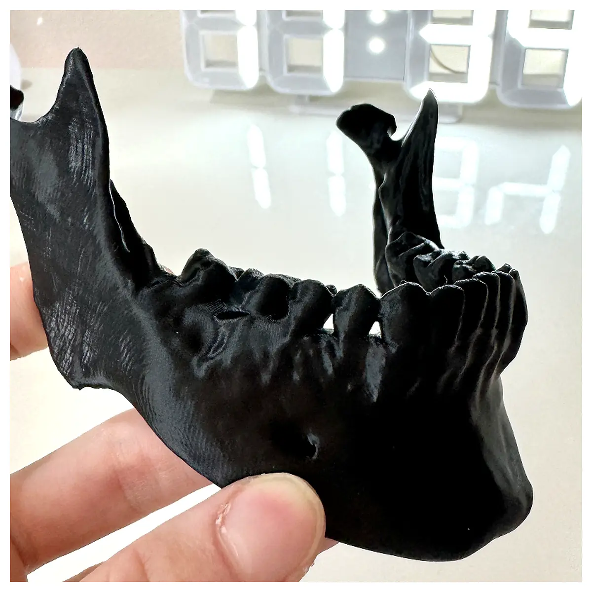 Jaw Joint Pain Relief Device Arthritis Treatment Tool Joint Diagnosis Support Joint Mobility Improvement Joint Stabilizer
