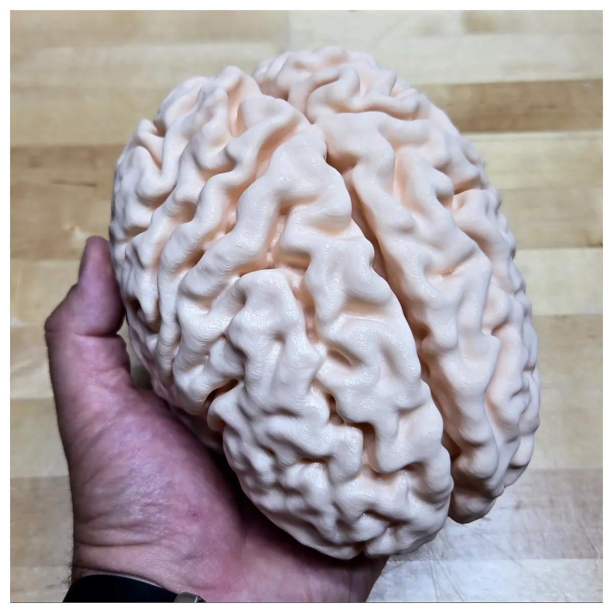 Full Brain MRI Model Neuroscience Research Brain Parts Neural Science Brain Scans Brain Anatomy