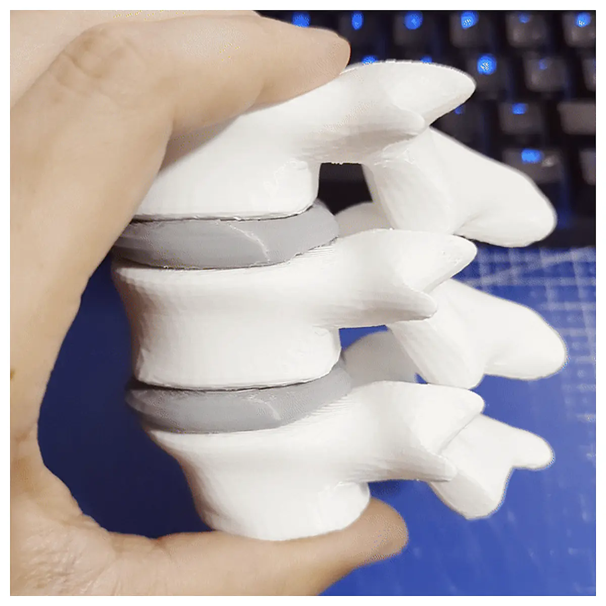 Lumbar Support L3 L5 Flexible Discs Back Pain Relief Spinal Support Vertebral Stability Chiropractic Treatment