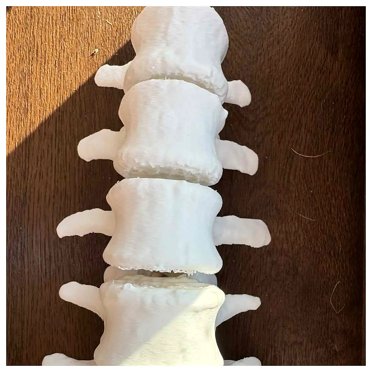 Lumbar Spine 3D Model Vertebrae Support Diagnosis Repair Parts Treatment