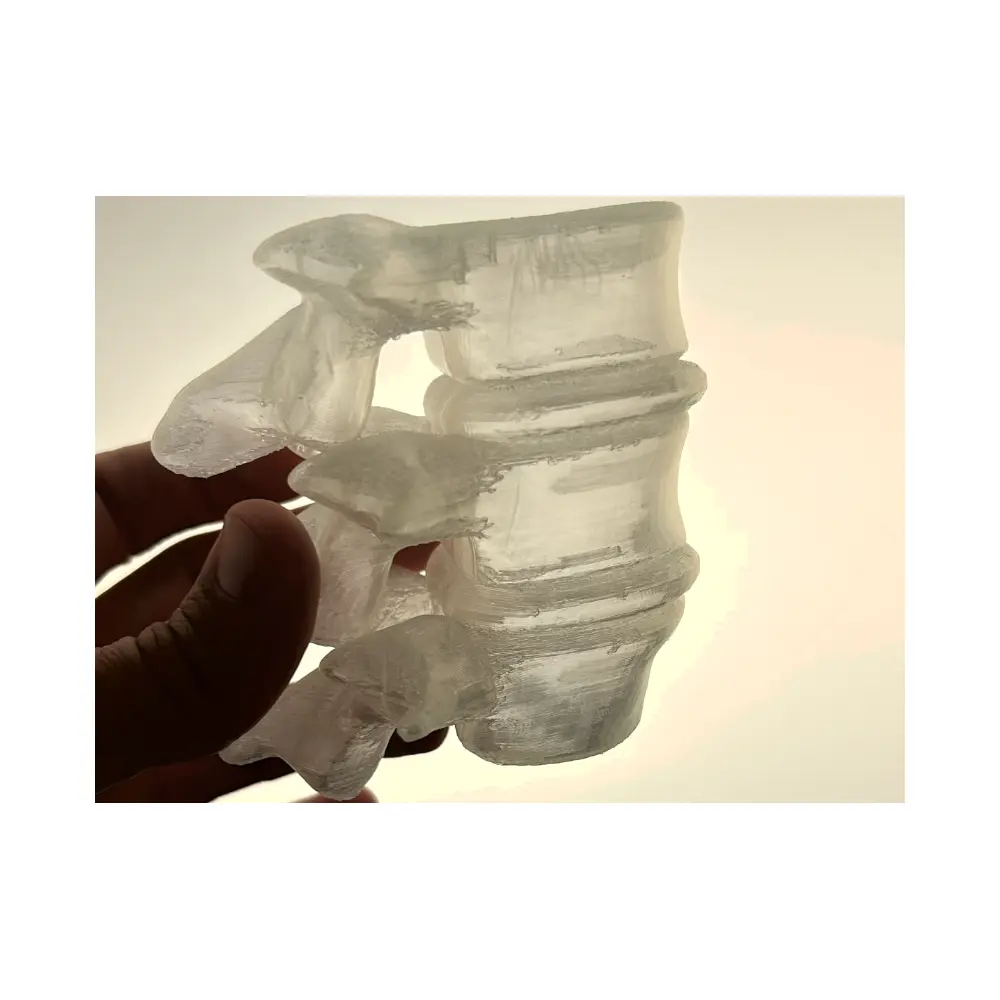 L3 L5 Vertebral Disc Translucent Dry Needling Bits Spinal Intervention Nerve Points Treatment