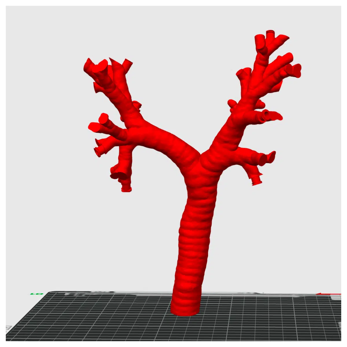 Trachea Bleeding Model Respiratory System Simulator Clinical Diagnosis Training Lung Disease Model Airway Bleeding Research
