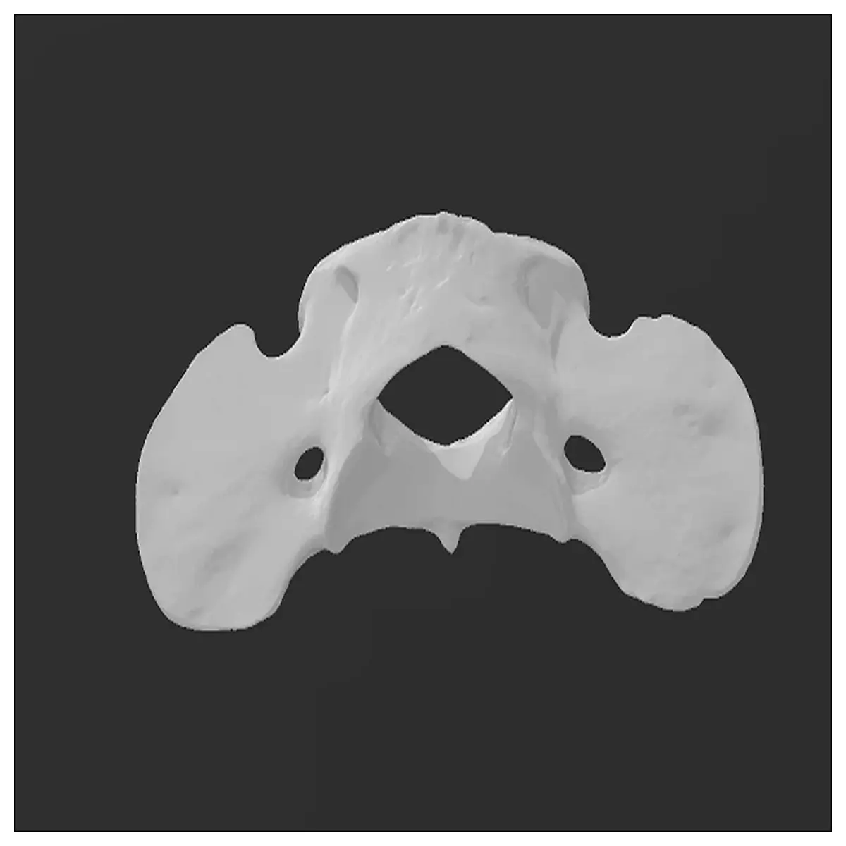 Dog Cervical Vertebra 3D Scan Pet Bone Scan Veterinary Diagnosis Spinal Analysis Canine Bone Model