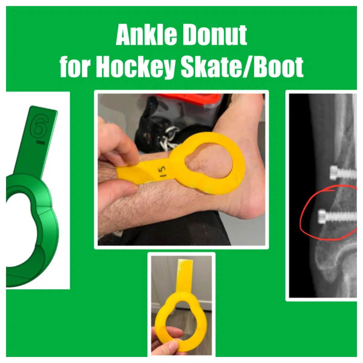 ankle donut cushion for ice skating injury support recovery padding