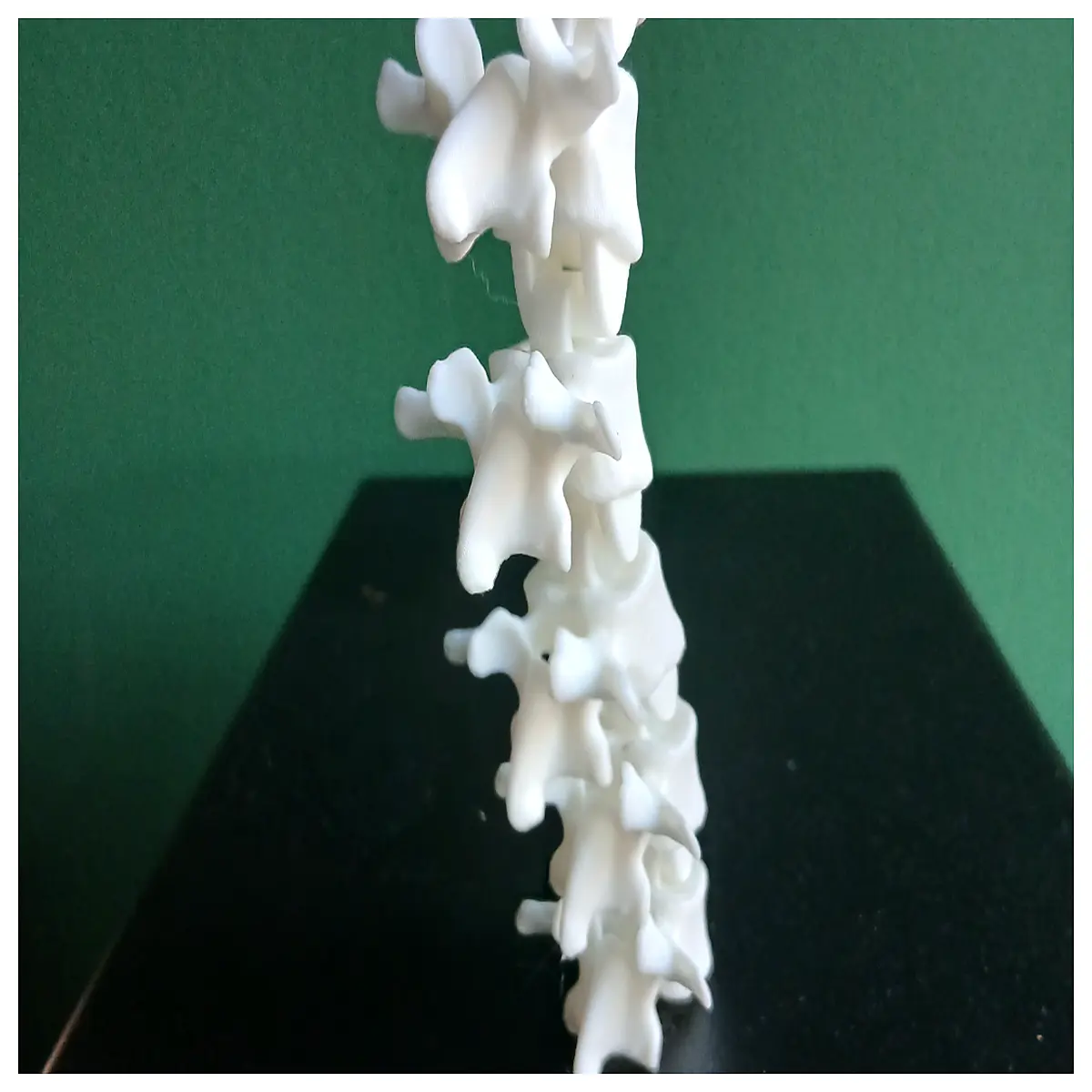 Spinal Decompression Toy Movable Joints Spine Massage Tool Vertebral Disc Support Spinal Health Maintenance