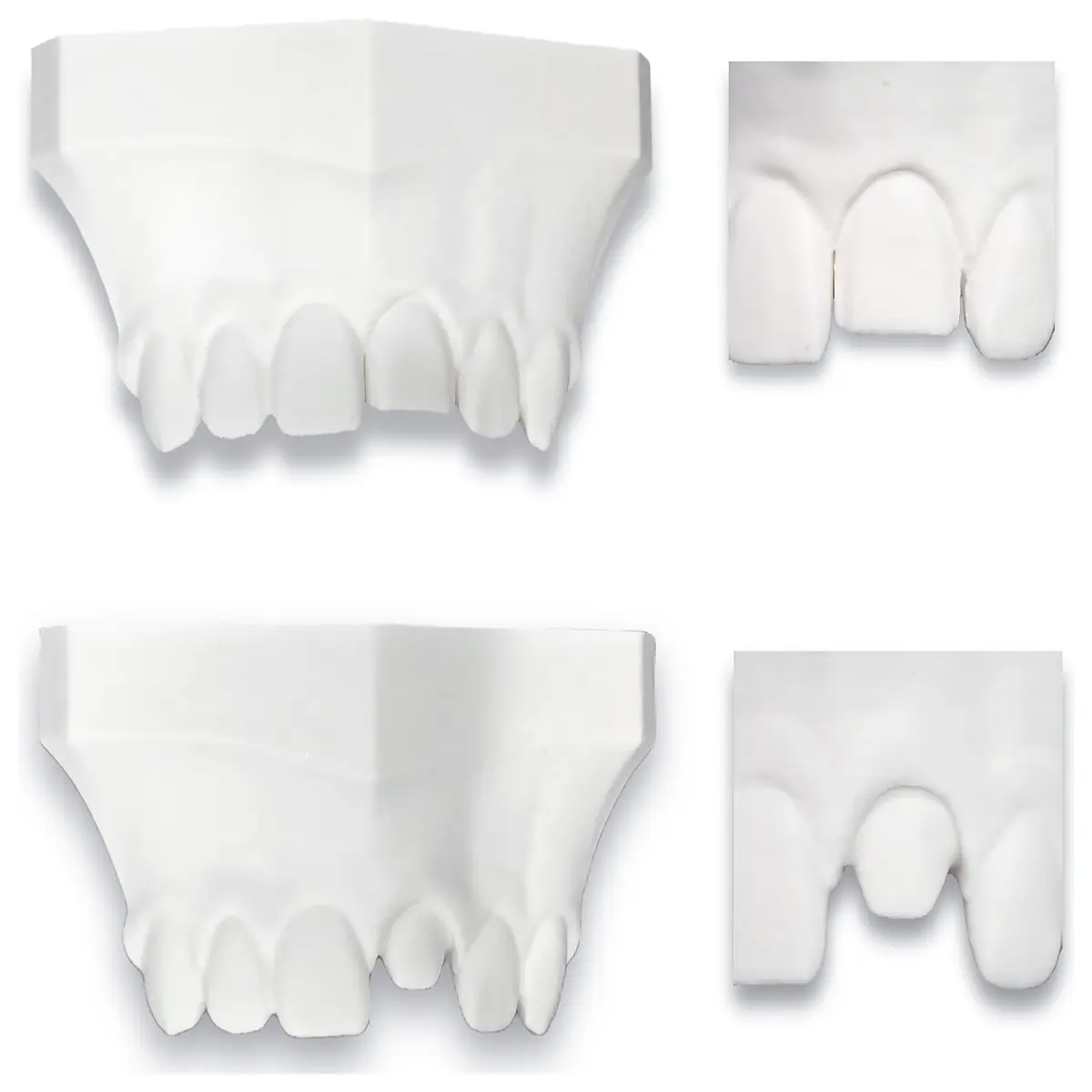 Dental Crown Preparation Model Anterior Veneer Demonstration Dental Education Model Crown Fabrication Veneer Technique Learning