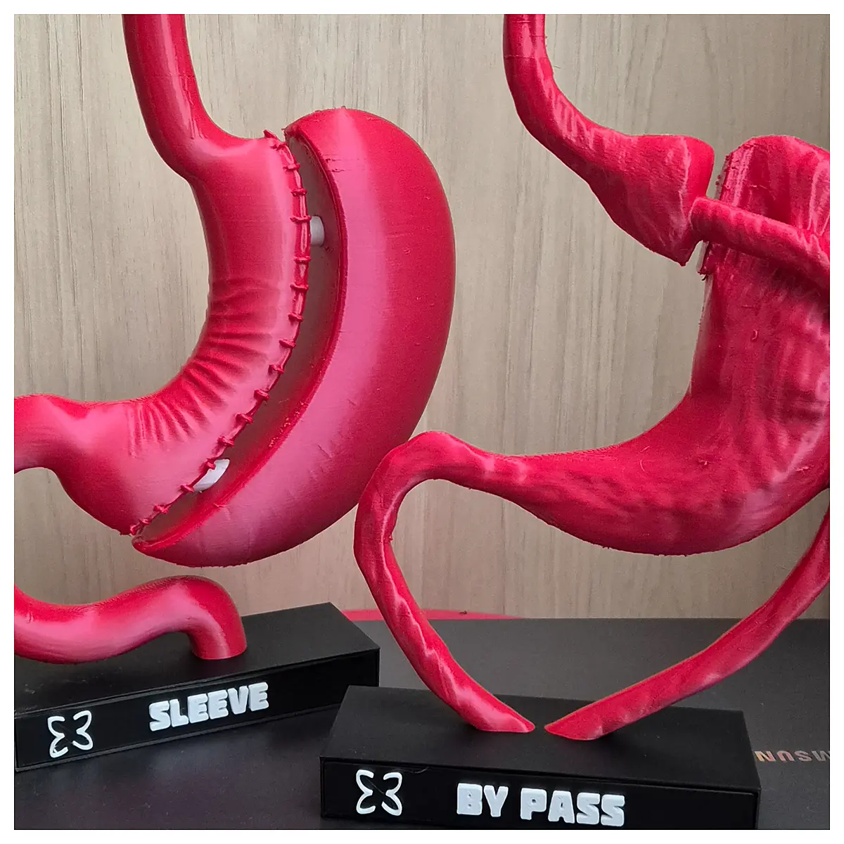 bariatric bypass sleeve surgery weight loss support supplements post op recovery nutrition vitamins for morbid obesity patients